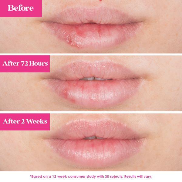 GrandePOUT Plumping Lip Mask Peach 15g.
